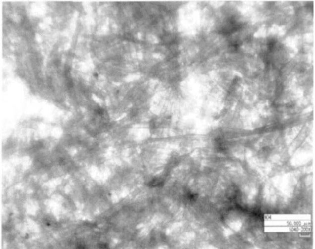 图3-脱酸样品透射CCD照片
