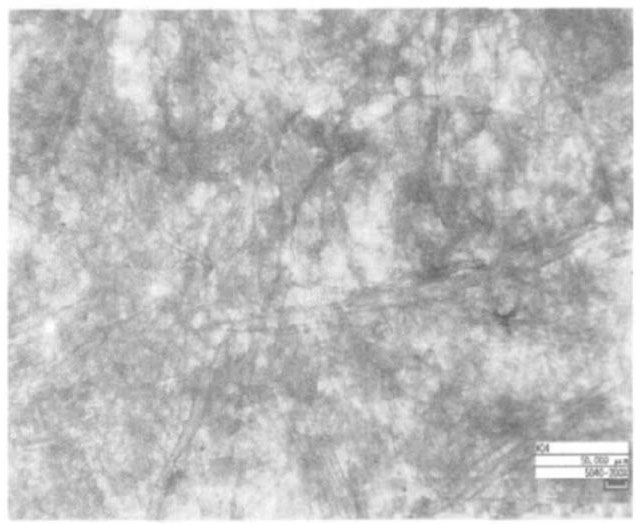 图2-未脱酸样品透射CCD照片